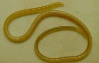 các loại ký sinh trùng trong cơ thể con người