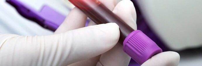 máu để xét nghiệm ký sinh trùng
