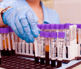 xét nghiệm máu cho ký sinh trùng