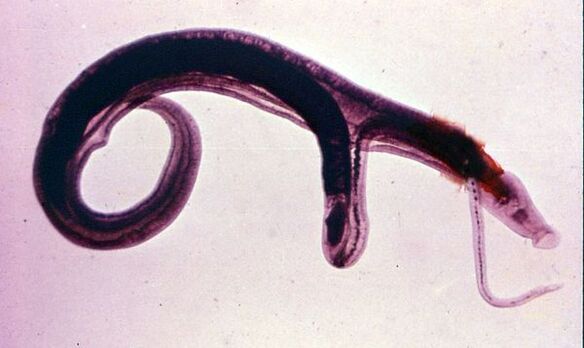Schistosome là một trong những loại ký sinh trùng phổ biến và nguy hiểm nhất